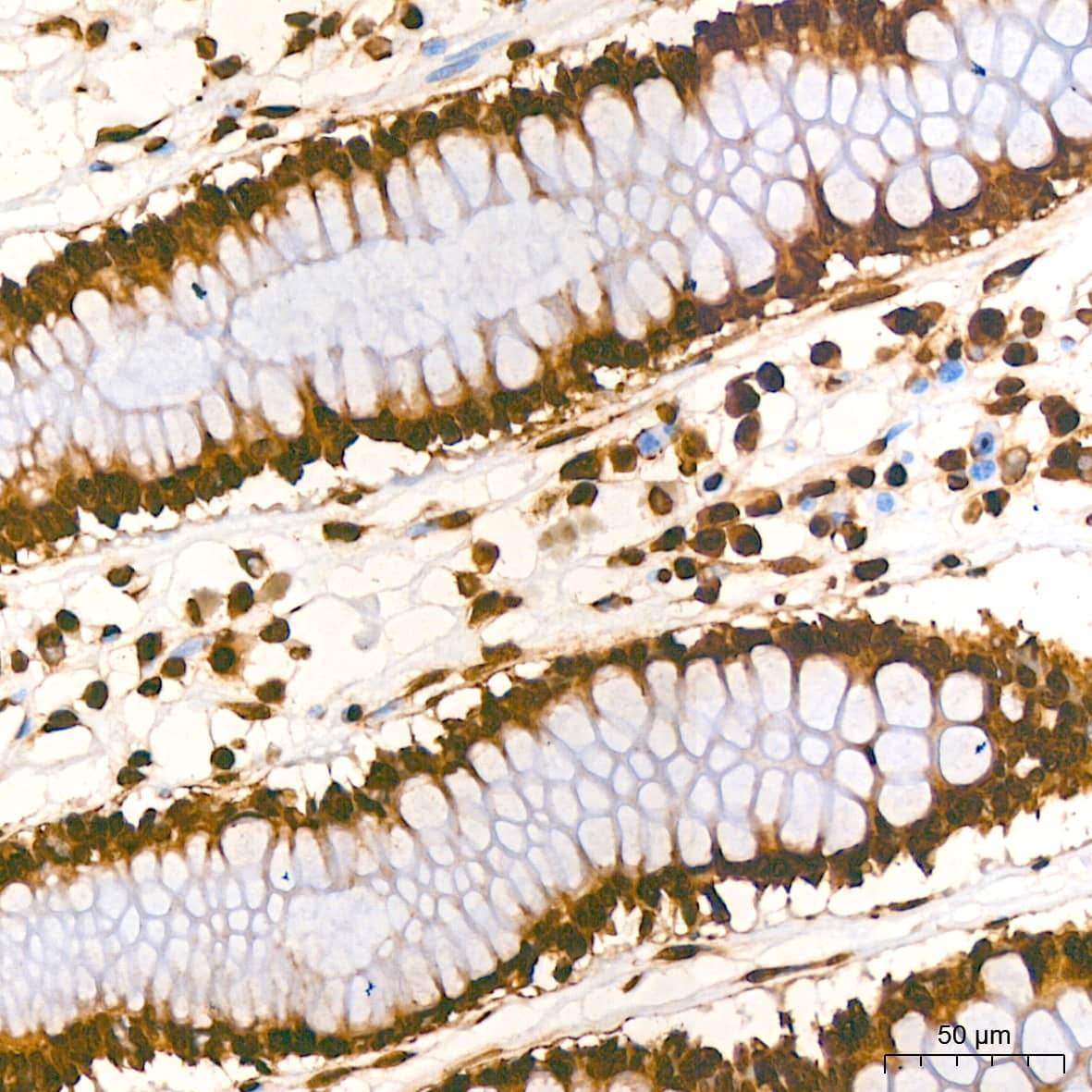 Immunohistochemistry: Histone H2AX Antibody (4Z3S8) [Histone H2AX] - Immunohistochemistry analysis of paraffin-embedded Human colon tissue using Histone H2AX Rabbit mAb  at a dilution of 1:800 (40x lens). High pressure antigen retrieval performed with 0.01M Citrate Bufferr (pH 6.0) prior to IHC staining.