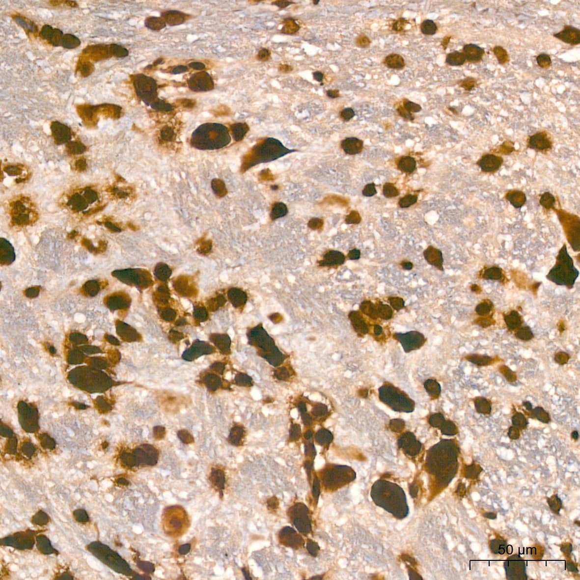 Immunohistochemistry: Histone H2AX Antibody (4Z3S8) [Histone H2AX] - Immunohistochemistry analysis of paraffin-embedded Mouse brain tissue using Histone H2AX Rabbit mAb  at a dilution of 1:800 (40x lens). High pressure antigen retrieval performed with 0.01M Citrate Bufferr (pH 6.0) prior to IHC staining.