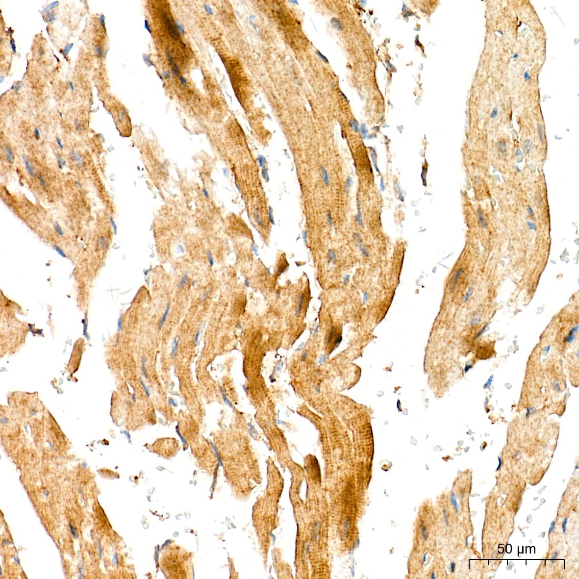 Immunohistochemistry: Aldolase A Antibody (4B2E5) [Aldolase A] - Immunohistochemistry analysis of paraffin-embedded Mouse heart tissue using Aldolase A Rabbit mAb  at a dilution of 1:200 (40x lens). High pressure antigen retrieval performed with 0.01M Tris-EDTA Buffer(pH 9.0) prior to IHC staining.