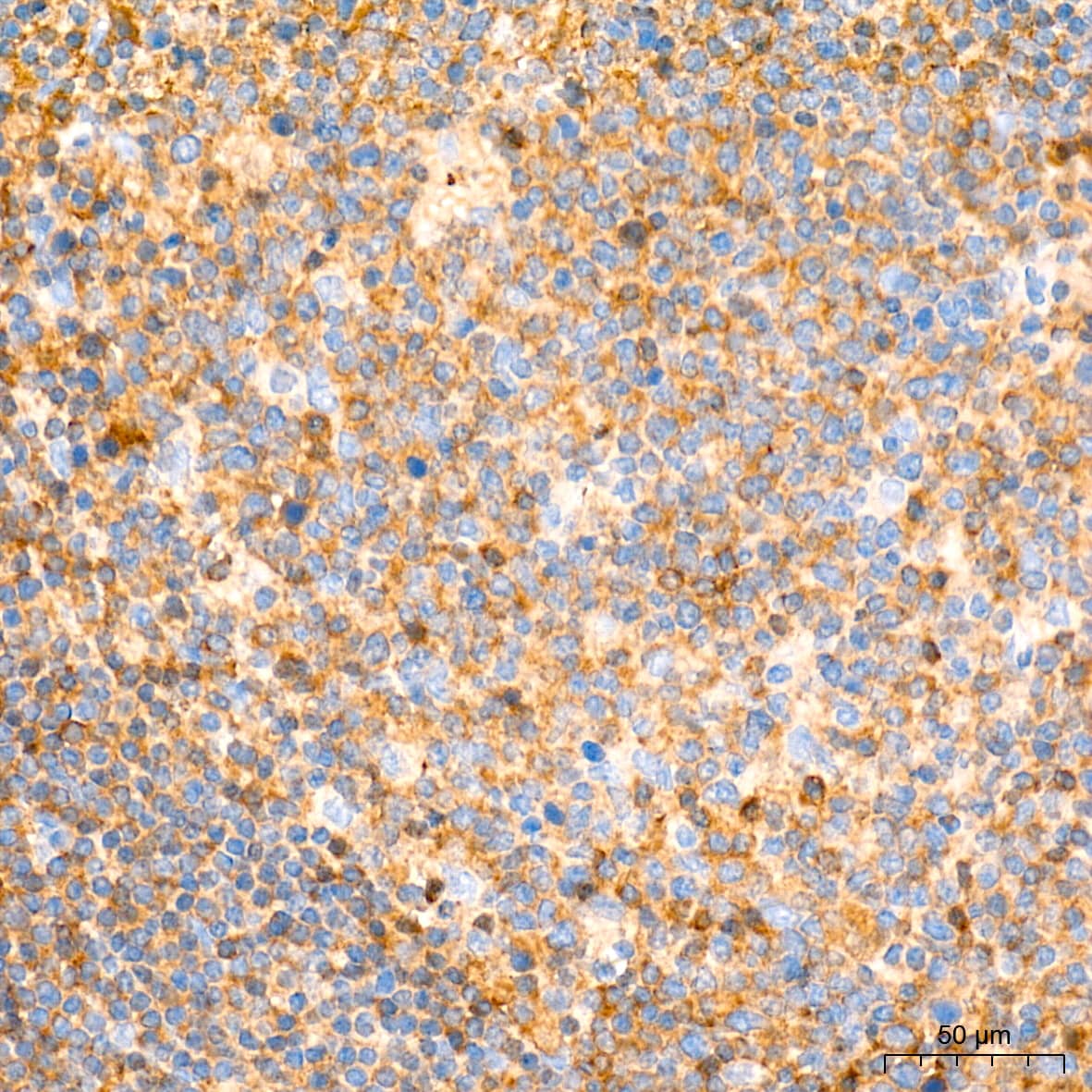 Immunohistochemistry: Aldolase A Antibody (4B2E5) [Aldolase A] - Immunohistochemistry analysis of paraffin-embedded Human tonsil tissue using Aldolase A Rabbit mAb  at a dilution of 1:200 (40x lens). High pressure antigen retrieval performed with 0.01M Tris-EDTA Buffer(pH 9.0) prior to IHC staining.