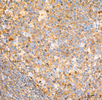 Immunohistochemistry-Paraffin: Aldolase A Antibody (4B2E5) [NBP3-15381] -Analysis of paraffin-embedded Human tonsil tissue using ALDOA Rabbit mAb at a dilution of 1:200 (40x lens). High pressure antigen retrieval performed with 0.01M Tris-EDTA Buffer (pH 9.0) prior to IHC staining.