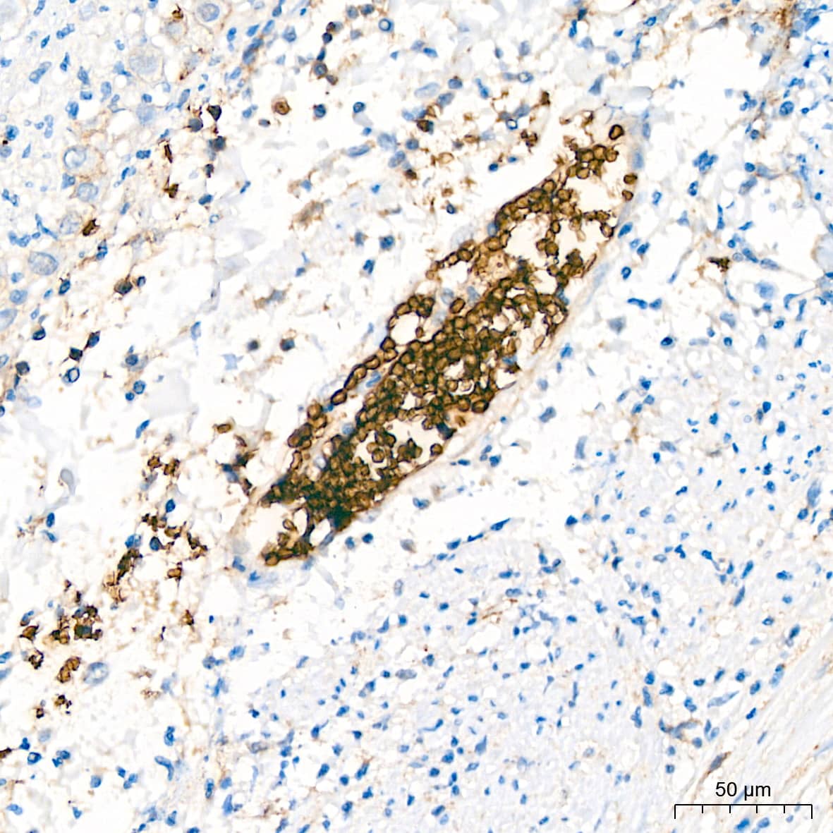 Immunohistochemistry: Glycophorin C Antibody (9K8U2) [Glycophorin C] - Immunohistochemistry analysis of paraffin-embedded Human appendix tissue using Glycophorin C Rabbit mAb  at a dilution of 1:200 (40x lens). High pressure antigen retrieval performed with 0.01M Citrate Buffer(pH 6.0) prior to IHC staining.