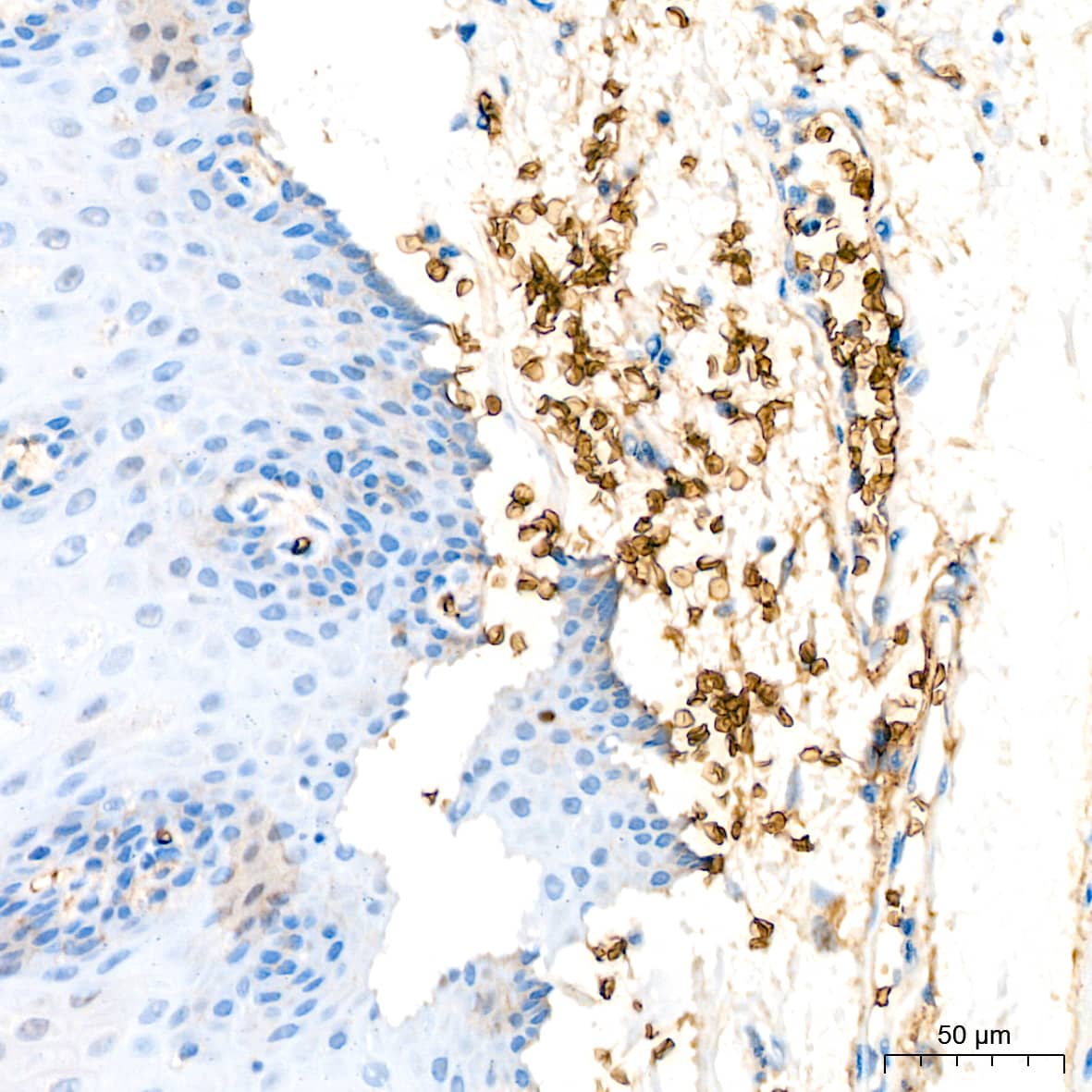 Immunohistochemistry: Glycophorin C Antibody (9K8U2) [Glycophorin C] - Immunohistochemistry analysis of paraffin-embedded Human esophagus tissue using Glycophorin C Rabbit mAb  at a dilution of 1:200 (40x lens). High pressure antigen retrieval performed with 0.01M Citrate Buffer(pH 6.0) prior to IHC staining.