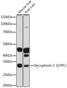 Western Blot: Glycophorin C Antibody (9K8U2) [Glycophorin C] - Western blot analysis of various lysates using Glycophorin C Rabbit mAb  at 1:1000 dilution.Secondary antibody: HRP Goat Anti-Rabbit IgG (H+L)  at 1:10000 dilution.Lysates/proteins: 25ug per lane.Blocking buffer: 3% nonfat dry milk in TBST.Detection: ECL Basic Kit .Exposure time: 30s.