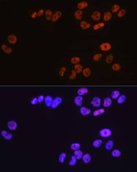 Immunocytochemistry/ Immunofluorescence: MCM3 Antibody (9Z5W4) [MCM3] - Immunofluorescence analysis of HeLa cells using MCM3 Rabbit mAb  at dilution of 1:100 (40x lens). Secondary antibody: Cy3-conjugated Goat anti-Rabbit IgG (H+L)  at 1:500 dilution. Blue: DAPI for nuclear staining.