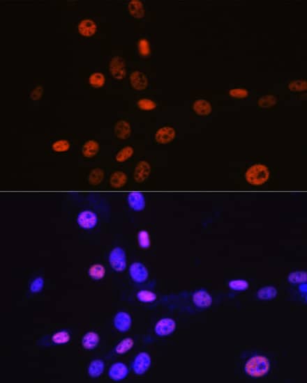 Immunocytochemistry/ Immunofluorescence: MCM3 Antibody (9Z5W4) [MCM3] - Immunofluorescence analysis of NIH-3T3 cells using MCM3 Rabbit mAb  at dilution of 1:100 (40x lens). Secondary antibody: Cy3-conjugated Goat anti-Rabbit IgG (H+L)  at 1:500 dilution. Blue: DAPI for nuclear staining.