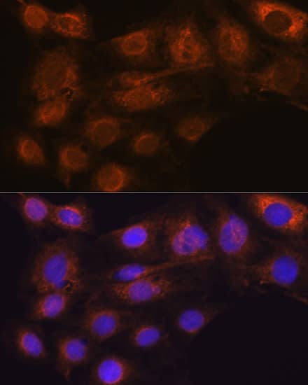 Immunocytochemistry/ Immunofluorescence: ARF6 Antibody (9E7T9) [ARF6] - Immunofluorescence analysis of C6 cells using ARF6 Rabbit mAb  at dilution of 1:100 (40x lens). Secondary antibody: Cy3-conjugated Goat anti-Rabbit IgG (H+L)  at 1:500 dilution. Blue: DAPI for nuclear staining.