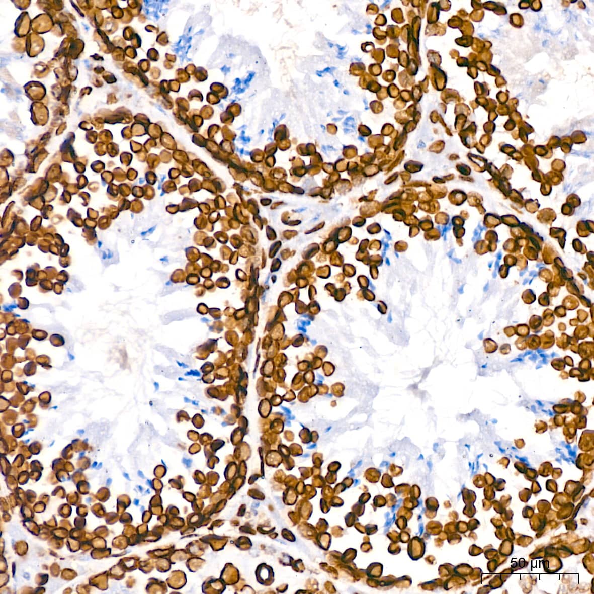 Immunohistochemistry: Lamin B1 Antibody (5H8V8) [Lamin B1] - Immunohistochemistry analysis of paraffin-embedded Mouse testis using Lamin B1 Rabbit mAb  at dilution of 1:200 (40x lens). High pressure antigen retrieval performed with 0.01M Citrate Bufferr (pH 6.0) prior to IHC staining.