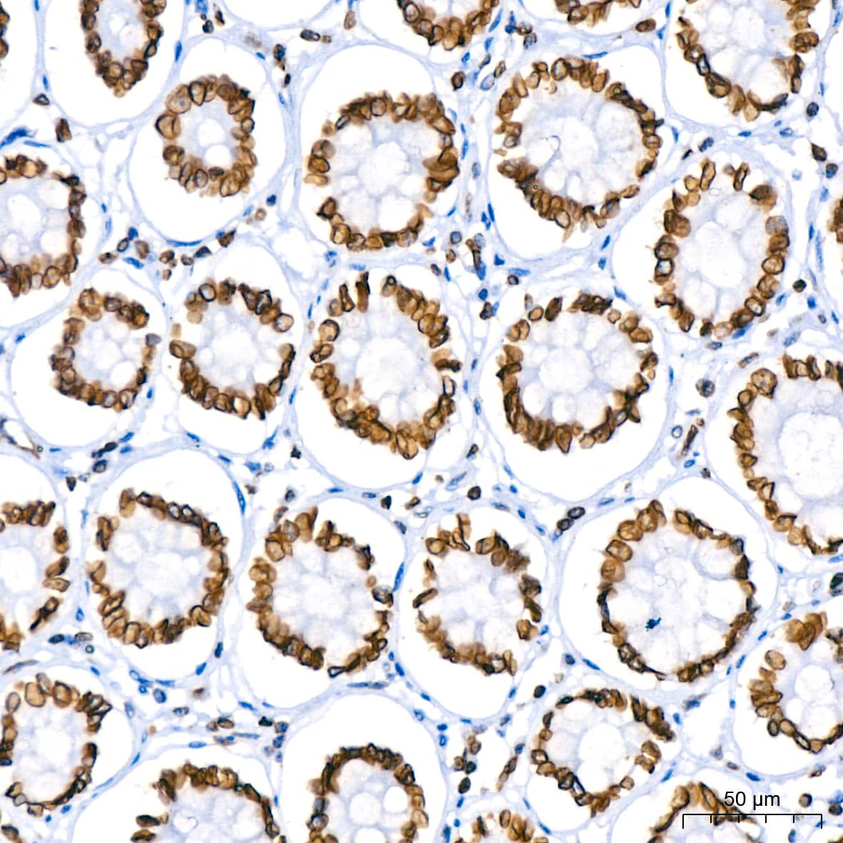 Immunohistochemistry: Lamin B1 Antibody (5H8V8) [Lamin B1] - Immunohistochemistry analysis of paraffin-embedded Human colon using Lamin B1 Rabbit mAb  at dilution of 1:400 (40x lens). High pressure antigen retrieval performed with 0.01M Citrate Bufferr (pH 6.0) prior to IHC staining.