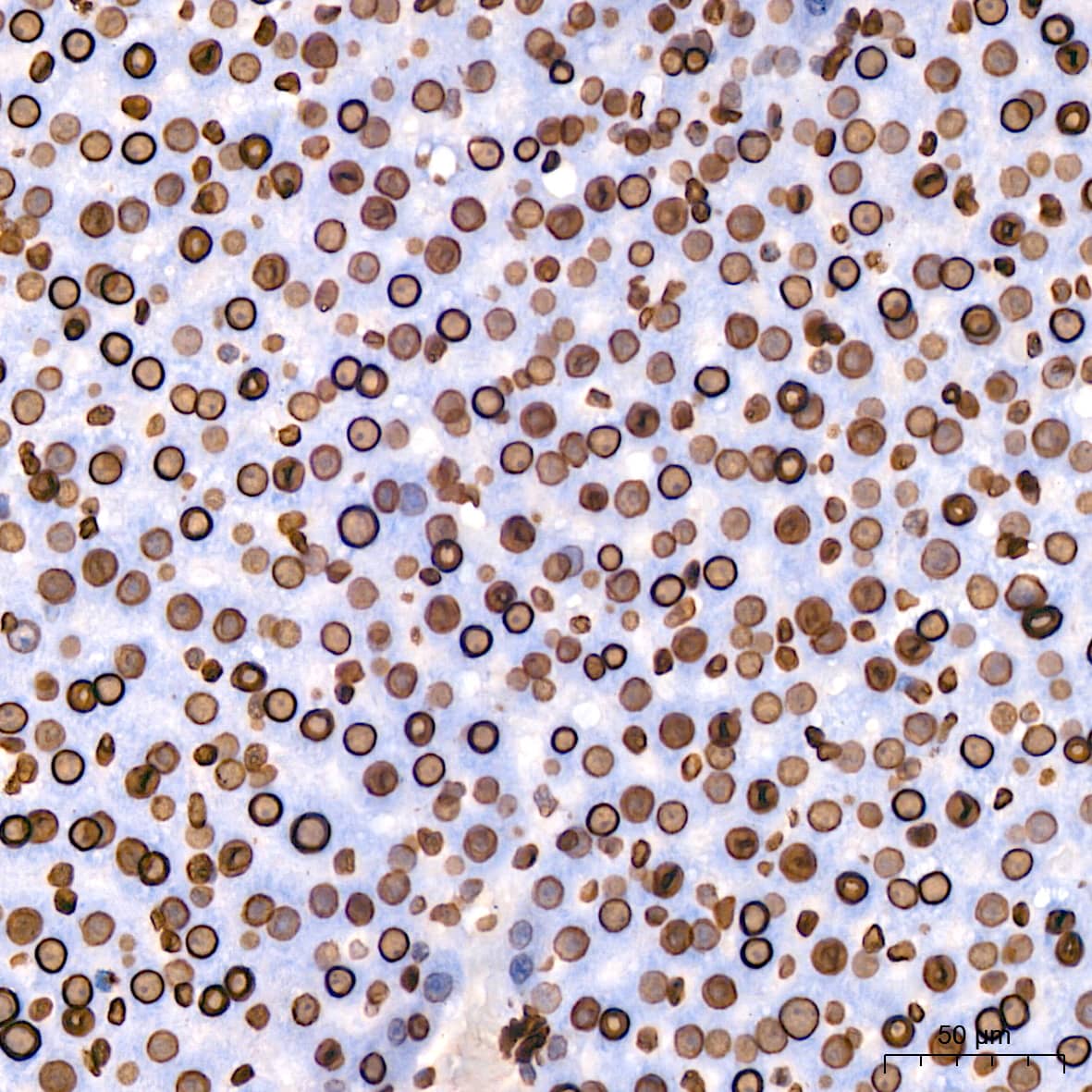 Immunohistochemistry: Lamin B1 Antibody (5H8V8) [Lamin B1] - Immunohistochemistry analysis of paraffin-embedded Rat liver using Lamin B1 Rabbit mAb  at dilution of 1:200 (40x lens). High pressure antigen retrieval performed with 0.01M Citrate Bufferr (pH 6.0) prior to IHC staining.