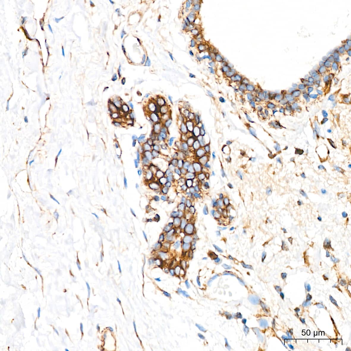 Immunohistochemistry: LOX Antibody (9K10Z3) [LOX] - Immunohistochemistry analysis of paraffin-embedded Human breast tissue using LOX Rabbit mAb  at a dilution of 1:200 (40x lens). High pressure antigen retrieval performed with 0.01M Citrate Bufferr (pH 6.0) prior to IHC staining.