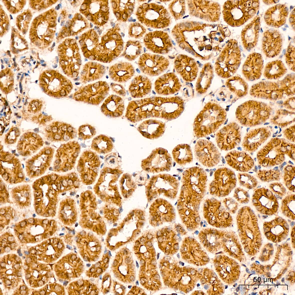 Immunohistochemistry: LOX Antibody (9K10Z3) [LOX] - Immunohistochemistry analysis of paraffin-embedded Mouse kidney tissue using LOX Rabbit mAb  at a dilution of 1:200 (40x lens). High pressure antigen retrieval performed with 0.01M Citrate Bufferr (pH 6.0) prior to IHC staining.