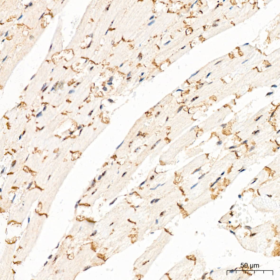 Immunohistochemistry: LOX Antibody (9K10Z3) [LOX] - Immunohistochemistry analysis of paraffin-embedded Rat heart tissue using LOX Rabbit mAb  at a dilution of 1:200 (40x lens). High pressure antigen retrieval performed with 0.01M Citrate Bufferr (pH 6.0) prior to IHC staining.