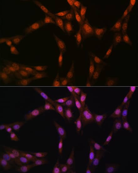 Immunocytochemistry/ Immunofluorescence: Glutathione Synthetase Antibody (2S9W7) [NBP3-15402] - Immunofluorescence analysis of NIH-3T3 cells using Glutathione Synthetase (GSS) Rabbit mAb  at dilution of 1:100 (40x lens). Blue: DAPI for nuclear staining.