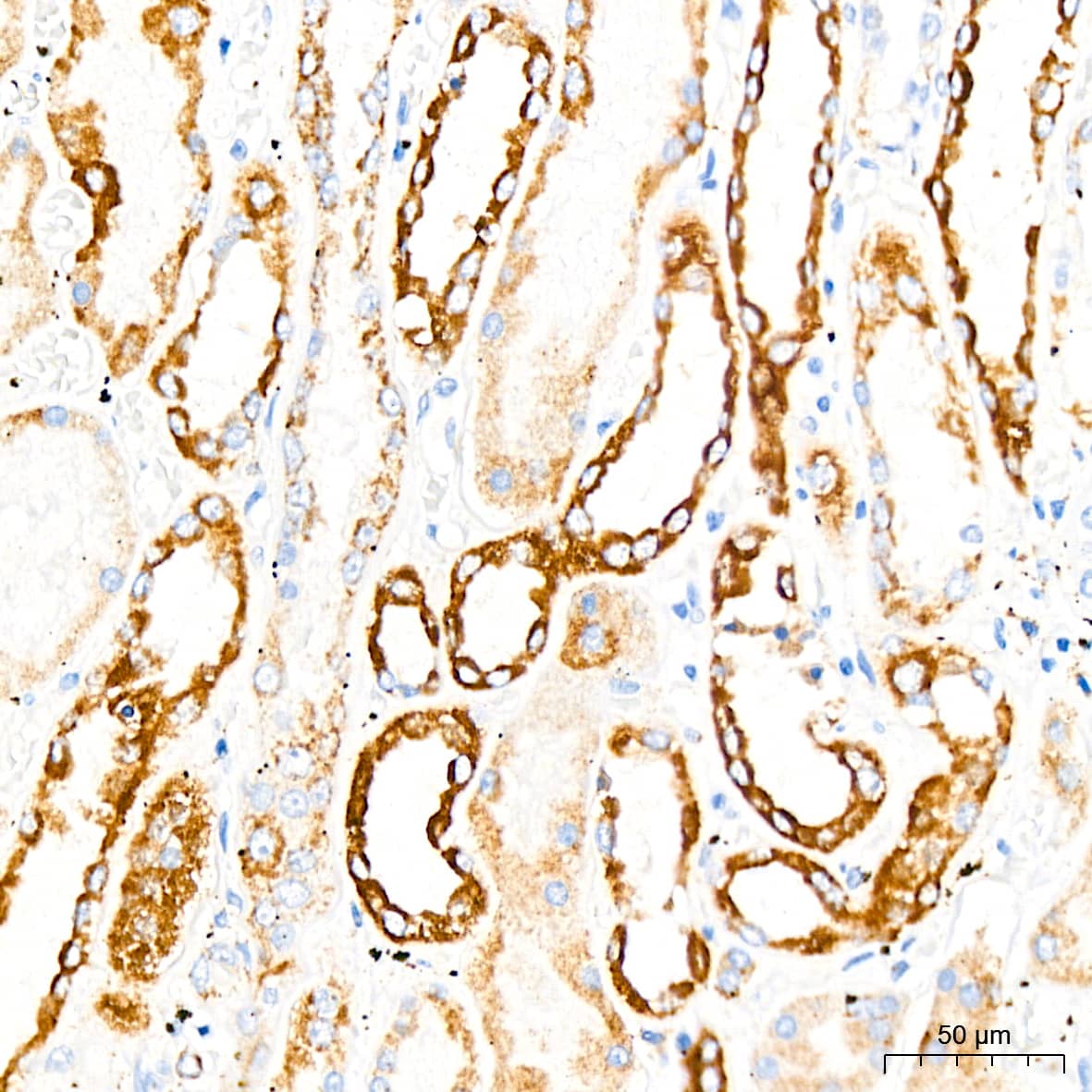 Immunohistochemistry: Monoamine Oxidase B Antibody (5M8A5) [NBP3-15411] - Immunohistochemistry analysis of Monoamine Oxidase B in paraffin-embedded human kidney tissue using Monoamine Oxidase B Rabbit mAb  at a dilution of 1:200 (40x lens).High pressure antigen retrieval was performed with 0.01 M citrate buffer (pH 6.0) prior to IHC staining.