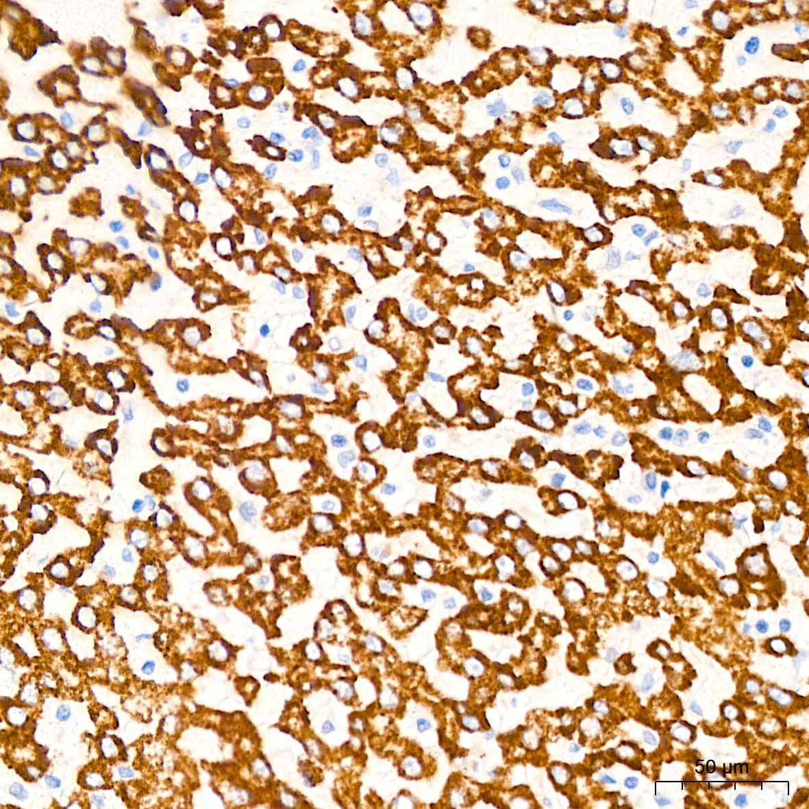 Immunohistochemistry: Monoamine Oxidase B Antibody (5M8A5) [NBP3-15411] - Immunohistochemistry analysis of Monoamine Oxidase B in paraffin-embedded human liver tissue using Monoamine Oxidase B Rabbit mAb  at a dilution of 1:200 (40x lens).High pressure antigen retrieval was performed with 0.01 M citrate buffer (pH 6.0) prior to IHC staining.