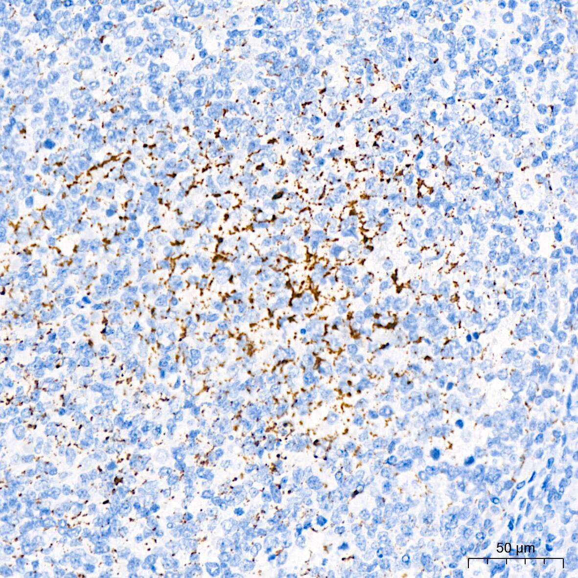 Immunohistochemistry: Monoamine Oxidase B Antibody (5M8A5) [NBP3-15411] - Immunohistochemistry analysis of Monoamine Oxidase B in paraffin-embedded human tonsil tissue using Monoamine Oxidase B Rabbit mAb  at a dilution of 1:200 (40x lens).High pressure antigen retrieval was performed with 0.01 M citrate buffer (pH 6.0) prior to IHC staining.