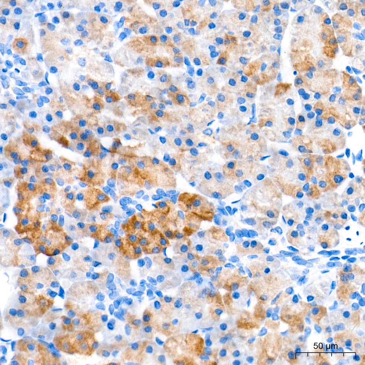 Immunohistochemistry: CBS Antibody (1R2E9) [CBS] - Immunohistochemistry analysis of paraffin-embedded Human pancreas tissue using CBS Rabbit mAb  at a dilution of 1:100 (40x lens). High pressure antigen retrieval performed with 0.01M Tris-EDTA Buffer (pH 9.0) prior to IHC staining.