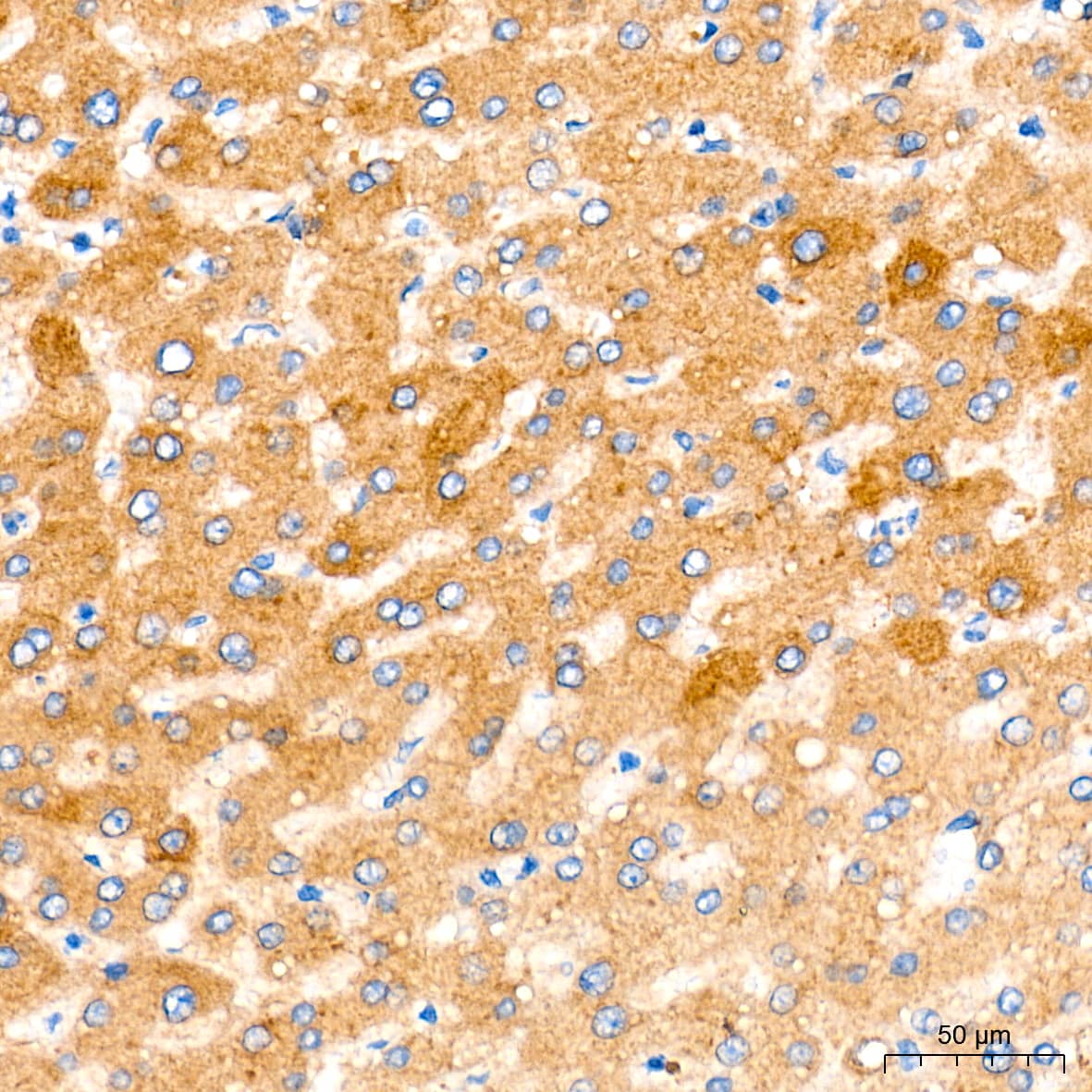 Immunohistochemistry: CBS Antibody (1R2E9) [CBS] - Immunohistochemistry analysis of paraffin-embedded Human liver tissue using CBS Rabbit mAb  at a dilution of 1:100 (40x lens). High pressure antigen retrieval performed with 0.01M Tris-EDTA Buffer (pH 9.0) prior to IHC staining.