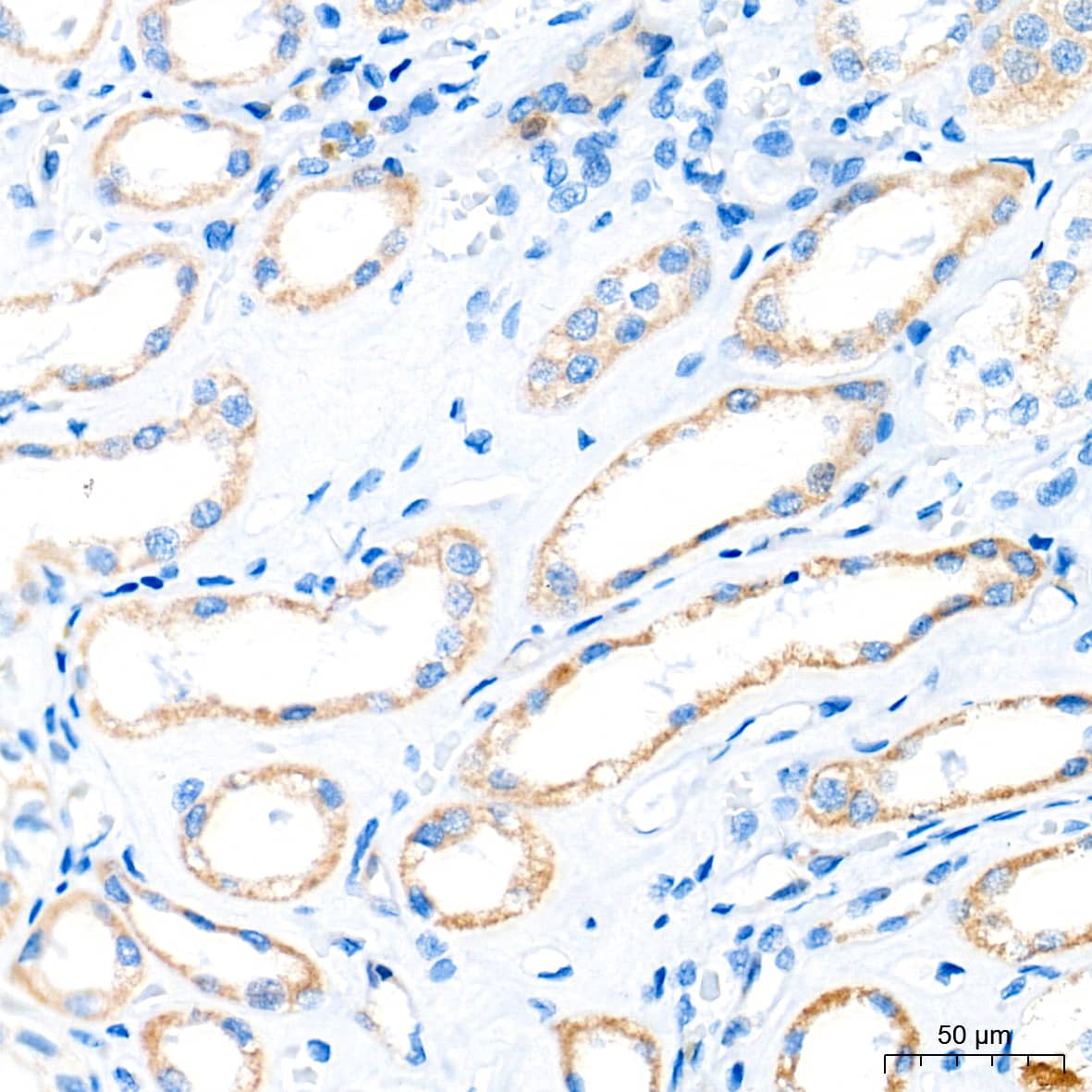 Immunohistochemistry: CBS Antibody (1R2E9) [CBS] - Immunohistochemistry analysis of paraffin-embedded Human kidney tissue using CBS Rabbit mAb  at a dilution of 1:100 (40x lens). High pressure antigen retrieval performed with 0.01M Tris-EDTA Buffer (pH 9.0) prior to IHC staining.