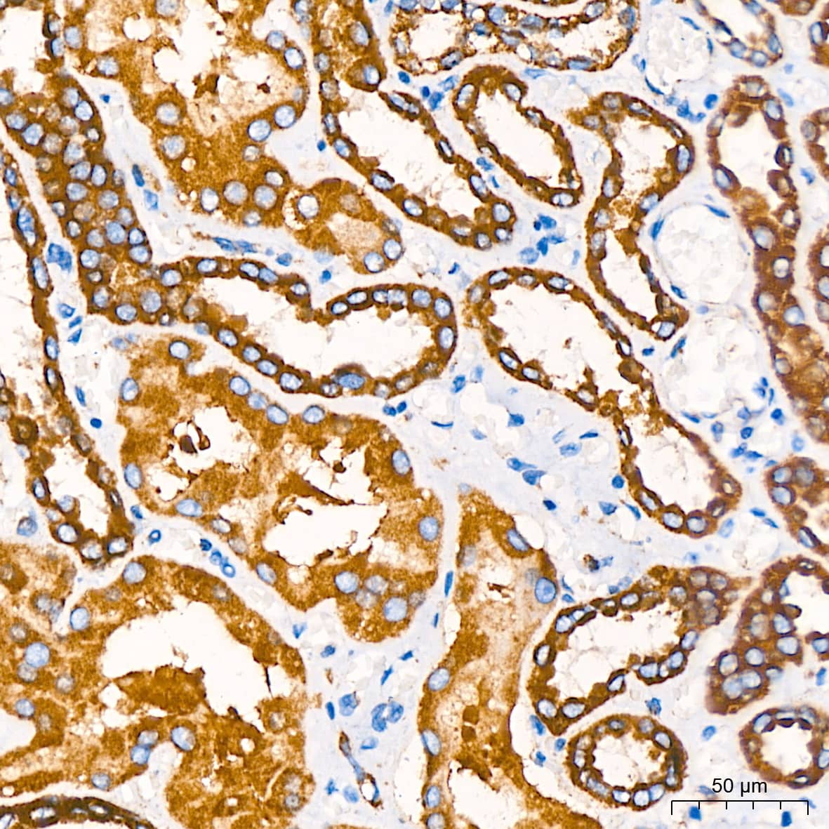 Immunohistochemistry: COX4 Antibody (3P8J2) [COX4] - Immunohistochemistry analysis of paraffin-embedded Human kidney using COX4 Rabbit mAb  at dilution of 1:200 (40x lens). High pressure antigen retrieval performed with 0.01M Citrate Bufferr (pH 6.0) prior to IHC staining.