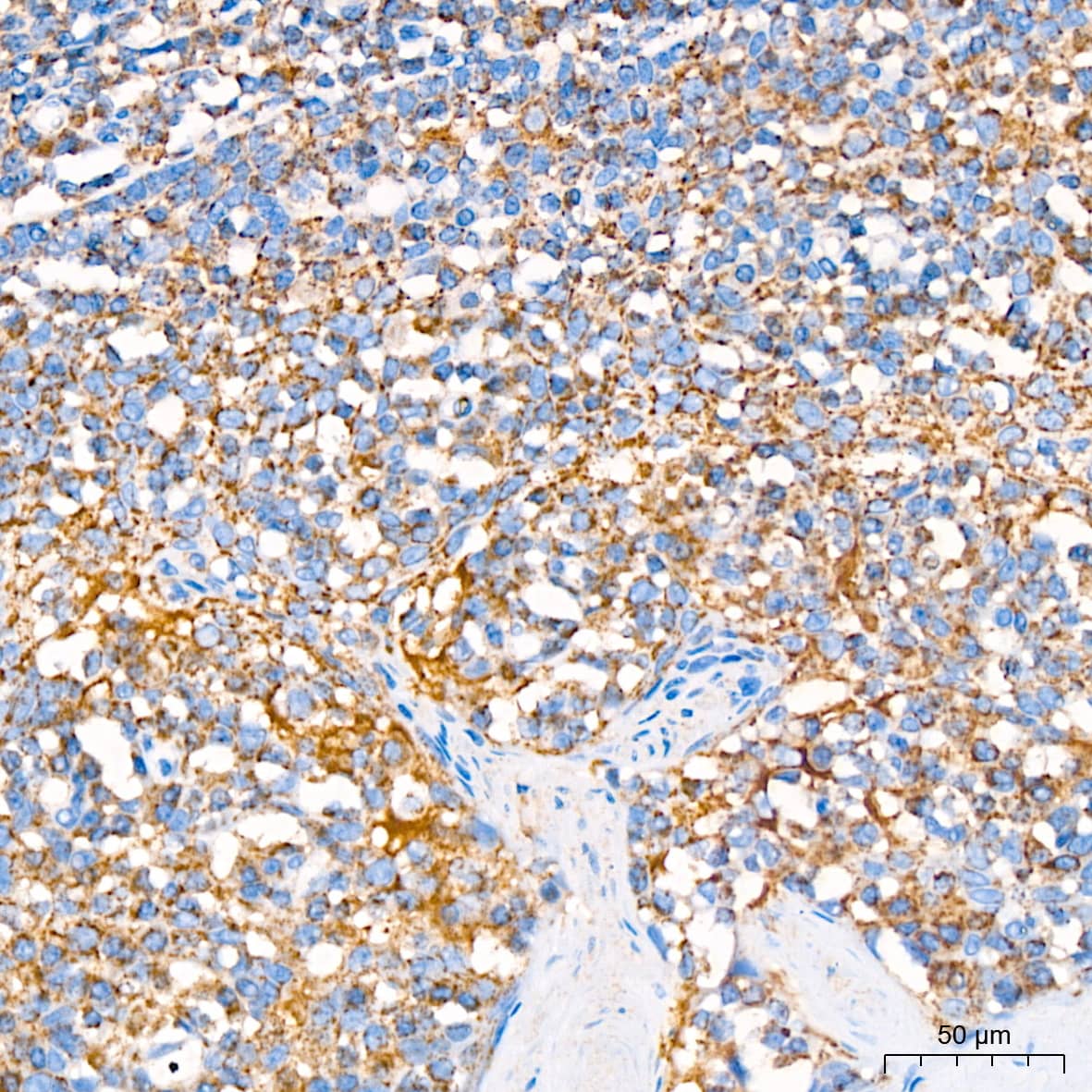 Immunohistochemistry: COX4 Antibody (3P8J2) [COX4] - Immunohistochemistry analysis of paraffin-embedded Human tonsil using COX4 Rabbit mAb  at dilution of 1:200 (40x lens). High pressure antigen retrieval performed with 0.01M Citrate Bufferr (pH 6.0) prior to IHC staining.