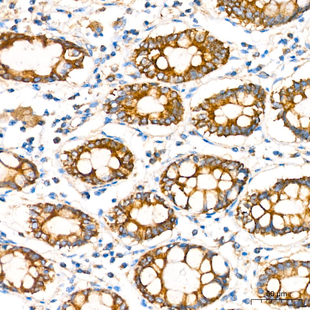 Immunohistochemistry: COX4 Antibody (3P8J2) [COX4] - Immunohistochemistry analysis of paraffin-embedded Human colon using COX4 Rabbit mAb  at dilution of 1:200 (40x lens). High pressure antigen retrieval performed with 0.01M Citrate Bufferr (pH 6.0) prior to IHC staining.