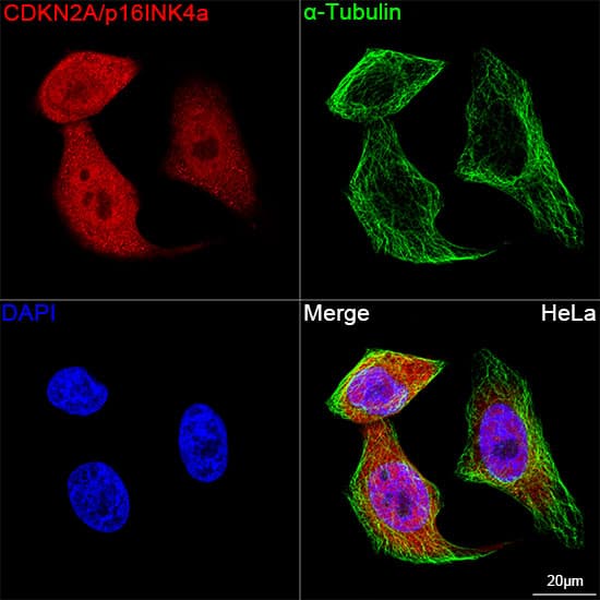 Immunocytochemistry/ Immunofluorescence: p16INK4a/CDKN2A Antibody (0D0C8) [p16INK4a/CDKN2A] - Confocal imaging of HeLa cells  using [KO Validated] p16INK4a/CDKN2A Rabbit mAb   followed by a further incubation with Cy3 Goat Anti-Rabbit IgG (H+L) .The cells were counterstained with alpha-Tubulin Mouse mAb  followed by incubation with ABflo 488-conjugated Goat Anti-Mouse IgG (H+L) Ab  (Green).DAPI was used for nuclear staining (Blue). Objective: 100x.