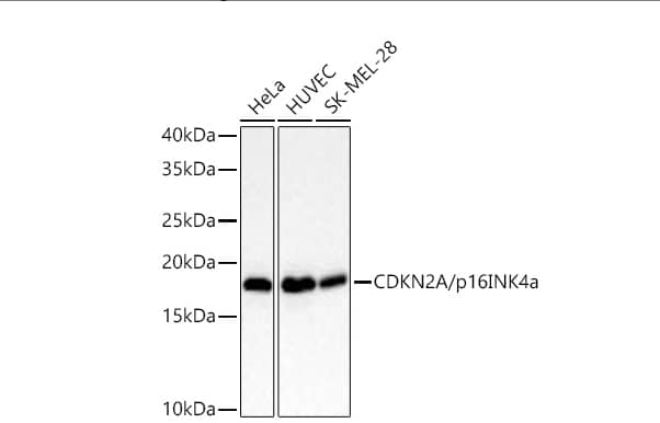 Analysis of various lysates using [KO Validated] CDKN2A/p16INK4a Rabbit mAb at 1:5000 dilution incubated overnight at 4℃.Secondary antibody: HRP-conjugated Goat anti-Rabbit IgG (H+L) at 1:10000 dilution.Lysates/proteins: 25 μg per lane.Blocking buffer: 3% nonfat dry milk in TBST.Detection: ECL Basic Kit. Exposure time: 20s.