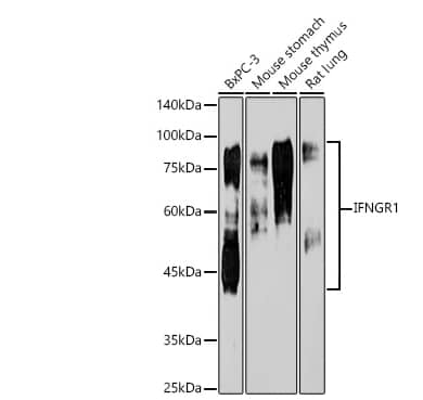 <b>Genetic Strategies Validation. </b>Analysis of various lysates, using [KO Validated] IFNGR1 Rabbit mAb at1:1000 dilution.Secondary antibody: HRP-conjugated Goat anti-Rabbit IgG (H+L) at 1:10000 dilution.Lysates/proteins: 25μg per lane.Blocking buffer: 3% nonfat dry milk in TBST.Detection: ECL Enhanced Kit. Exposure time: 180s.