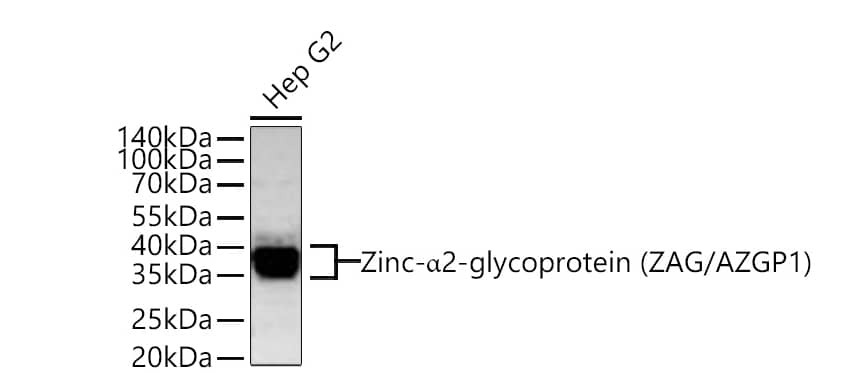  Analysis of lysates from Hep G2 cells using Zinc-alpha 2-glycoprotein (ZAG/AZGP1) Rabbit mAb at 1:1000 dilution incubated overnight at 4℃.Secondary antibody: HRP-conjugated Goat anti-Rabbit IgG (H+L) at 1:10000 dilution.Lysates/proteins: 25 μg per lane.Blocking buffer: 3% nonfat dry milk in TBST.Detection: ECL Basic Kit. Exposure time: 60 s.