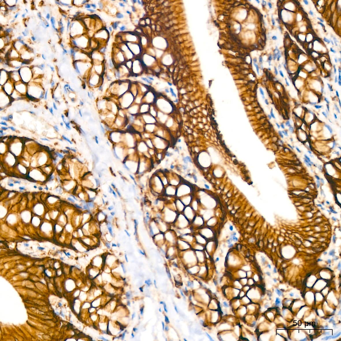 Immunohistochemistry: Sodium Potassium ATPase Alpha 1 Antibody (3L6F0) [Sodium Potassium ATPase Alpha 1] - Immunohistochemistry analysis of paraffin-embedded Rat colon tissue using Sodium Potassium ATPase Alpha 1 Rabbit mAb  at dilution of 1:400 (40x lens). High pressure antigen retrieval performed with 0.01M Citrate Bufferr (pH 6.0) prior to IHC staining.