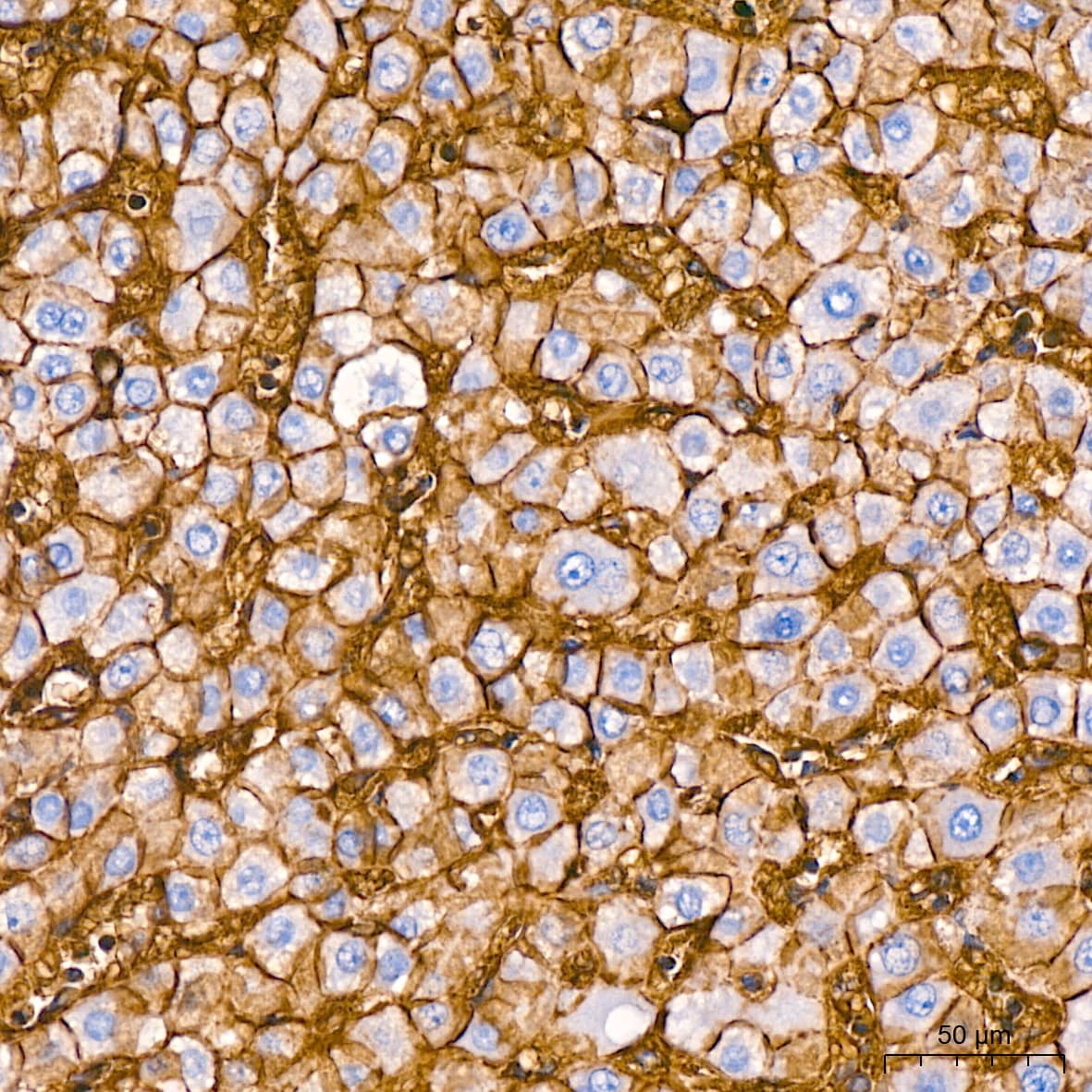 Immunohistochemistry: Sodium Potassium ATPase Alpha 1 Antibody (3L6F0) [Sodium Potassium ATPase Alpha 1] - Immunohistochemistry analysis of paraffin-embedded Human liver tissue using Sodium Potassium ATPase Alpha 1 Rabbit mAb  at dilution of 1:200 (40x lens). High pressure antigen retrieval performed with 0.01M Citrate Bufferr (pH 6.0) prior to IHC staining.