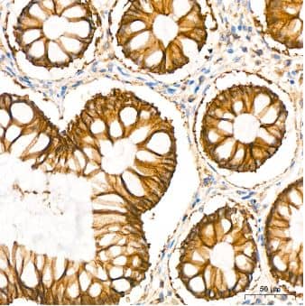 Immunohistochemistry-Paraffin: Sodium Potassium ATPase Alpha 1 Antibody (3L6F0) [NBP3-15427] - Analysis of Na+/K+-ATPase in paraffin-embedded human colon using Na+/K+-ATPase Rabbit mAb at dilution of 1:400 (40x lens).Perform high pressure antigen retrieval with 10 mM citrate buffer pH 6.0 before commencing with IHC staining protocol.