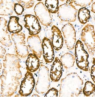 Immunohistochemistry-Paraffin: Sodium Potassium ATPase Alpha 1 Antibody (3L6F0) [NBP3-15427] -  Analysis of Na+/K+-ATPase in paraffin-embedded human kidney using Na+/K+-ATPase Rabbit mAb at dilution of 1:400 (40x lens).Perform high pressure antigen retrieval with 10 mM citrate buffer pH 6.0 before commencing with IHC staining protocol.