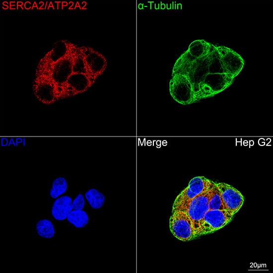 Immunocytochemistry/ Immunofluorescence: SERCA2 ATPase Antibody (10F0M9) [SERCA2 ATPase] - Confocal imaging of Hep G2 cells using SERCA2 ATPase Rabbit mAb  followed by a further incubation with Cy3 Goat Anti-Rabbit IgG (H+L)  . The cells were counterstained with alpha-Tubulin Mouse mAb  followed by incubation with ABflo 488-conjugated Goat Anti-Mouse IgG (H+L) Ab  (Green). DAPI was used for nuclear staining (Blue). Objective: 100x.