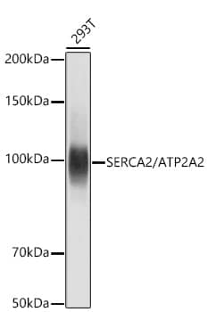 Western Blot: SERCA2 ATPase Antibody (10F0M9) [SERCA2 ATPase] - Western blot analysis of various lysates using SERCA2 ATPase Rabbit mAb  at 1:1000 dilution.Secondary antibody: HRP-conjugated Goat anti-Rabbit IgG (H+L)  at 1:10000 dilution.Lysates/proteins: 25ug per lane.Blocking buffer: 3% nonfat dry milk in TBST.Detection: ECL Basic Kit .Exposure time: 1s.