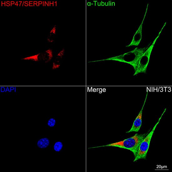 Immunocytochemistry/ Immunofluorescence: Hsp47 Antibody (3K3H1) [Hsp47] - Confocal imaging of NIH/3T3 cells  using Hsp47 Rabbit mAb   followed by a further incubation with Cy3 Goat Anti-Rabbit IgG (H+L) .The cells were counterstained with alpha-Tubulin Mouse mAb  followed by incubation with ABflo 488-conjugated Goat Anti-Mouse IgG (H+L) Ab  (Green).DAPI was used for nuclear staining (Blue). Objective: 100x.