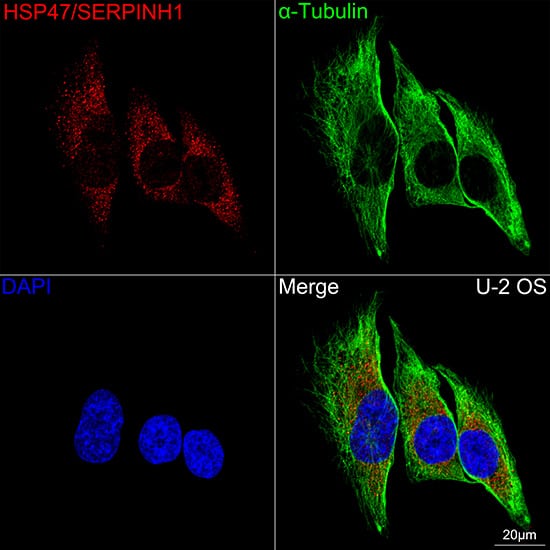 Immunocytochemistry/ Immunofluorescence: Hsp47 Antibody (3K3H1) [Hsp47] - Confocal imaging of U-2 OS cells  using Hsp47 Rabbit mAb   followed by a further incubation with Cy3 Goat Anti-Rabbit IgG (H+L) .The cells were counterstained with alpha-Tubulin Mouse mAb  followed by incubation with ABflo 488-conjugated Goat Anti-Mouse IgG (H+L) Ab  (Green).DAPI was used for nuclear staining (Blue). Objective: 100x.