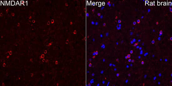 Immunocytochemistry/ Immunofluorescence: NMDAR1 Antibody (1H1T3) [NMDAR1] - Immunofluorescence analysis of paraffin-embedded Rat brain tissue using NMDAR1 Rabbit mAb  at a dilution of 1:100 (40x lens). Secondary antibody:Cy3 Goat Anti-Rabbit IgG (H+L)  at 1:500 dilution. Blue: DAPI for nuclear staining. Perform microwave antigen retrieval with 0.01 M citrate buffer (pH 6.0) prior to IF staining.