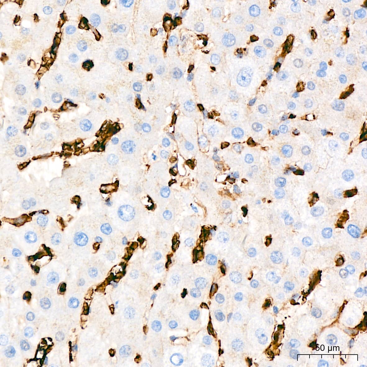 Immunohistochemistry: Glut1 Antibody (10O1I5) [Glut1] - Immunohistochemistry analysis of paraffin-embedded Human liver tissue using Glut1 Rabbit mAb  at a dilution of 1:800 (40x lens). High pressure antigen retrieval performed with 0.01M Tris-EDTA Buffer (pH 9.0) prior to IHC staining.