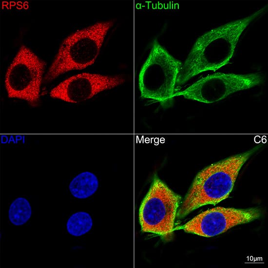 Immunocytochemistry/ Immunofluorescence: Ribosomal Protein S6/RPS6 Antibody (4C7P4) [Ribosomal Protein S6/RPS6] - Confocal imaging of C6 cells using Ribosomal Protein S6/RPS6 Rabbit mAb . The cells were counterstained with alpha-Tubulin Mouse mAb  (Green). DAPI was used for nuclear staining (blue). Objective: 100x.