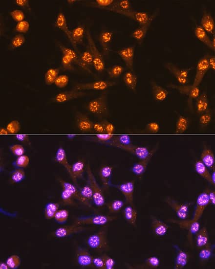 Immunocytochemistry/ Immunofluorescence: CDC25C Antibody (6R0I6) [NBP3-15437] - Immunofluorescence analysis of HeLa cells using CDC25C Rabbit mAb  at dilution of 1:100 (40x lens). Secondary antibody: Cy3 Goat Anti-Rabbit IgG (H+L)  at 1:500 dilution. Blue: DAPI for nuclear staining.