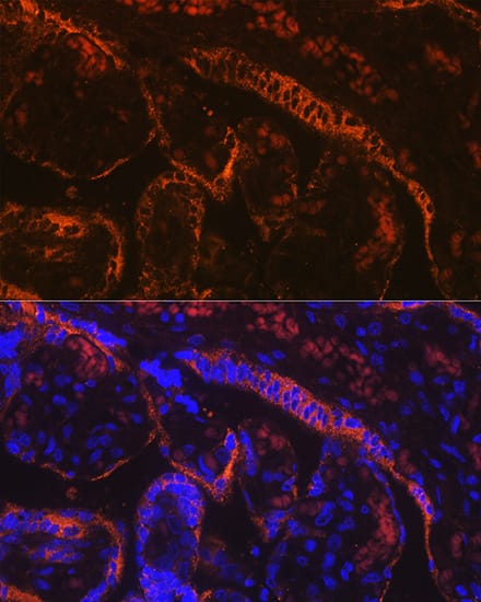 Immunocytochemistry/ Immunofluorescence: Aromatase Antibody (5C5N7) [Aromatase] - Immunofluorescence analysis of paraffin-embedded human placenta using Aromatase Rabbit mAb  at dilution of 1:100 (40x lens). Secondary antibody: Cy3-conjugated Goat anti-Rabbit IgG (H+L)  at 1:500 dilution. Blue: DAPI for nuclear staining.