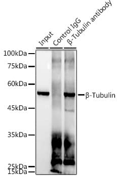 Immunoprecipitation: beta Tubulin Antibody (4E9G8) [beta Tubulin] - Immunoprecipitation analysis of 300 ug extracts of 293T cells using 3 ug beta Tubulin antibody . Western blot was performed from the immunoprecipitate using beta Tubulin antibody  at a dilution of 1:1000.