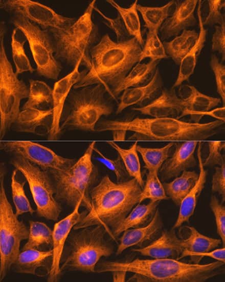 Immunocytochemistry/ Immunofluorescence: beta Tubulin Antibody (4E9G8) [beta Tubulin] - Immunofluorescence analysis of U2OS cells using beta Tubulin Rabbit mAb  at dilution of 1:100. Blue: DAPI for nuclear staining.