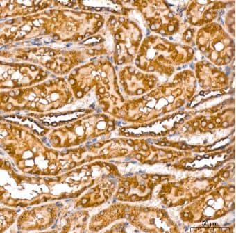 Immunohistochemistry-Paraffin: beta Tubulin Antibody (4E9G8) [NBP3-15439] -Analysis of paraffin-embedded Rat kidney tissue using  beta -Tubulin Rabbit mAb  at a dilution of 1:200 (40x lens). High pressure antigen retrieval performed with 0.01M Citrate Buffer (pH 6.0) prior to IHC staining.