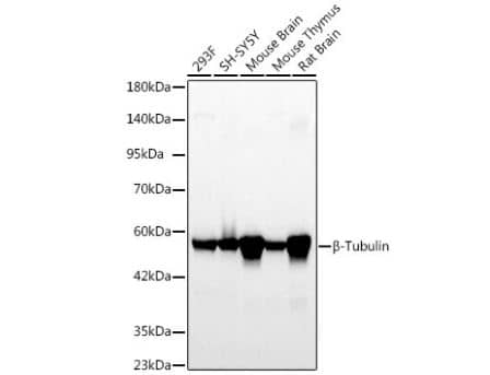 Western Blot: beta Tubulin Antibody (4E9G8) [NBP3-15439] - Analysis of various lysates using  beta -Tubulin Rabbit mAb at 1:5000 dilution.Secondary antibody: HRP-conjugated Goat anti-Rabbit IgG (H+L) at 1:10000 dilution.Lysates/proteins: 25ug per lane.Blocking buffer: 3% nonfat dry milk in TBST.Detection: ECL Basic Kit. Exposure time: 20s.