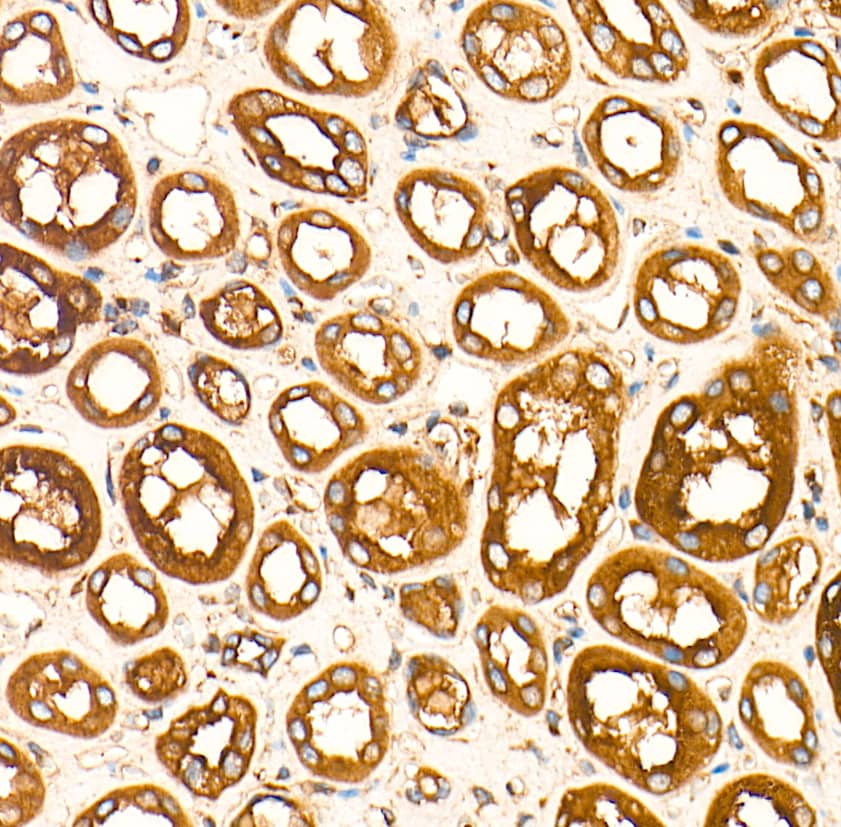  Analysis of paraffin-embedded Mouse testis tissue using RAB7 Rabbit mAb at a dilution of 1:3000 (40x lens). High pressure antigen retrieval performed with 0.01M Tris-EDTA Buffer (pH 9.0) prior to IHC staining.