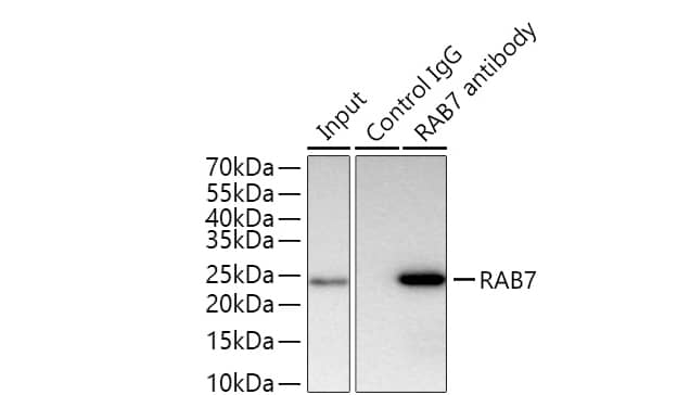 RAB7 from 300 µg extracts of HeLa cells was performed using 0.5 µg of RAB7 Rabbit mAb.  Rabbit Control IgG (AC005) was used to precipitate the Control IgG sample. IP samples were eluted with 1x Laemmli Buffer. The Input lane represents 10% of the total input. Western blot analysis of immunoprecipitates was conducted using RAB7 Rabbit mAb at a dilution of 1:5000.